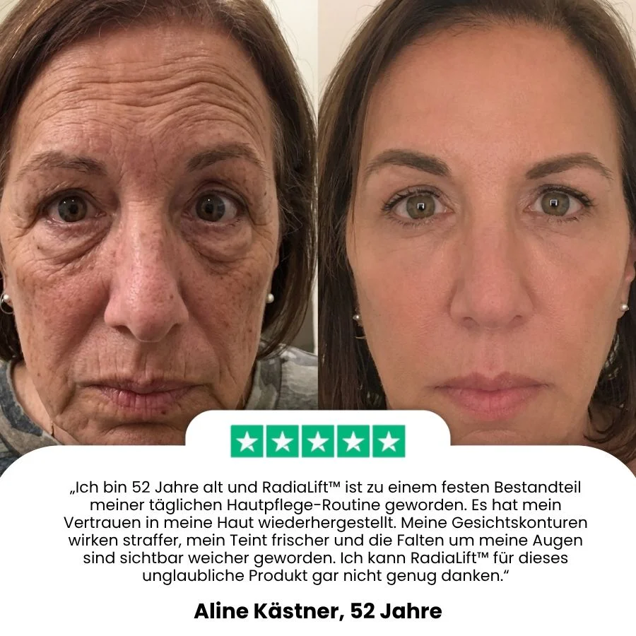 RadiaLift™ | Anti-Aging Roll-on-Essenz-Booster - Image 3