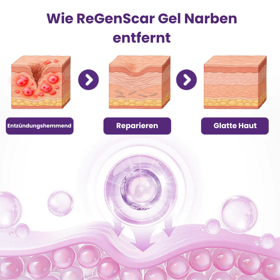ReGenScar™ | Stammzellen-Narbengel - Image 2
