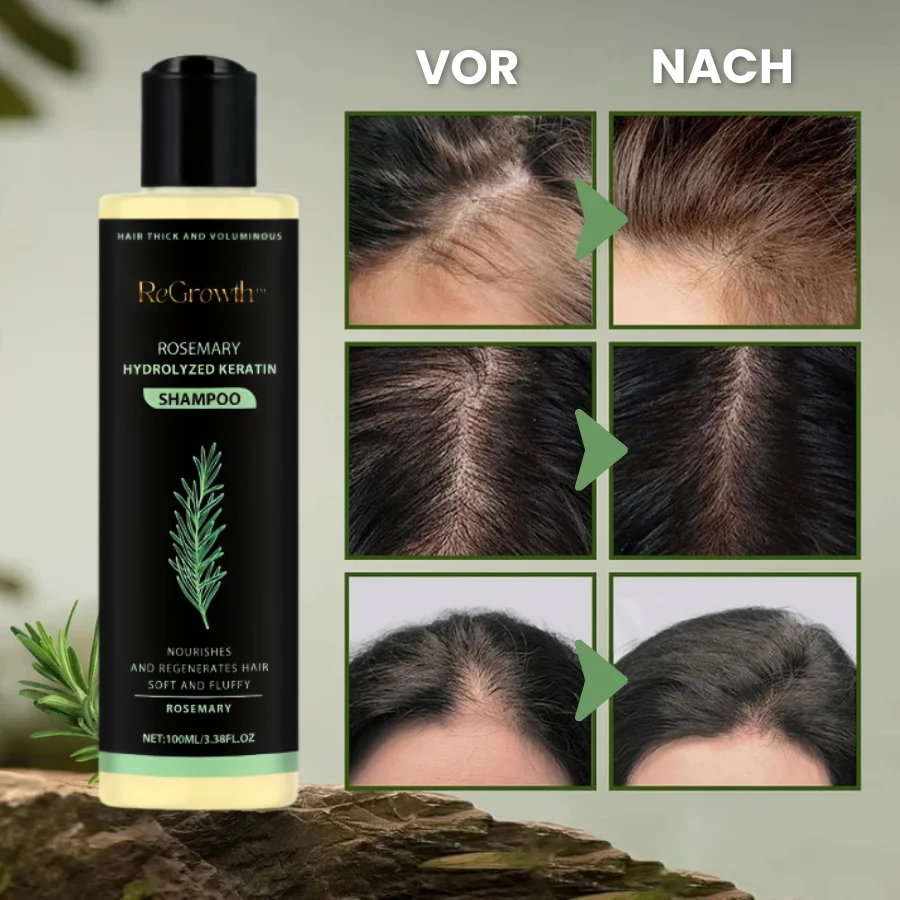 ReGrowth™ | Bio-Rosmarin-Haarwuchsshampoo - Image 4