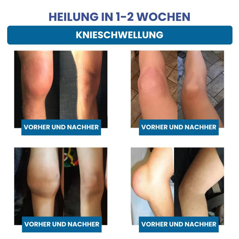 ReparaJoint™ | Stoppe Arthrose sofort und hole dir in nur 7 Tagen 95 % deiner Beweglichkeit zurück - Image 8