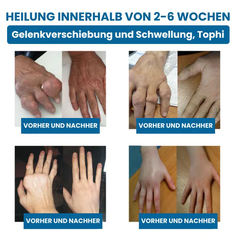 ReparaJoint™ | Stoppe Arthrose sofort und hole dir in nur 7 Tagen 95 % deiner Beweglichkeit zurück - Image 9