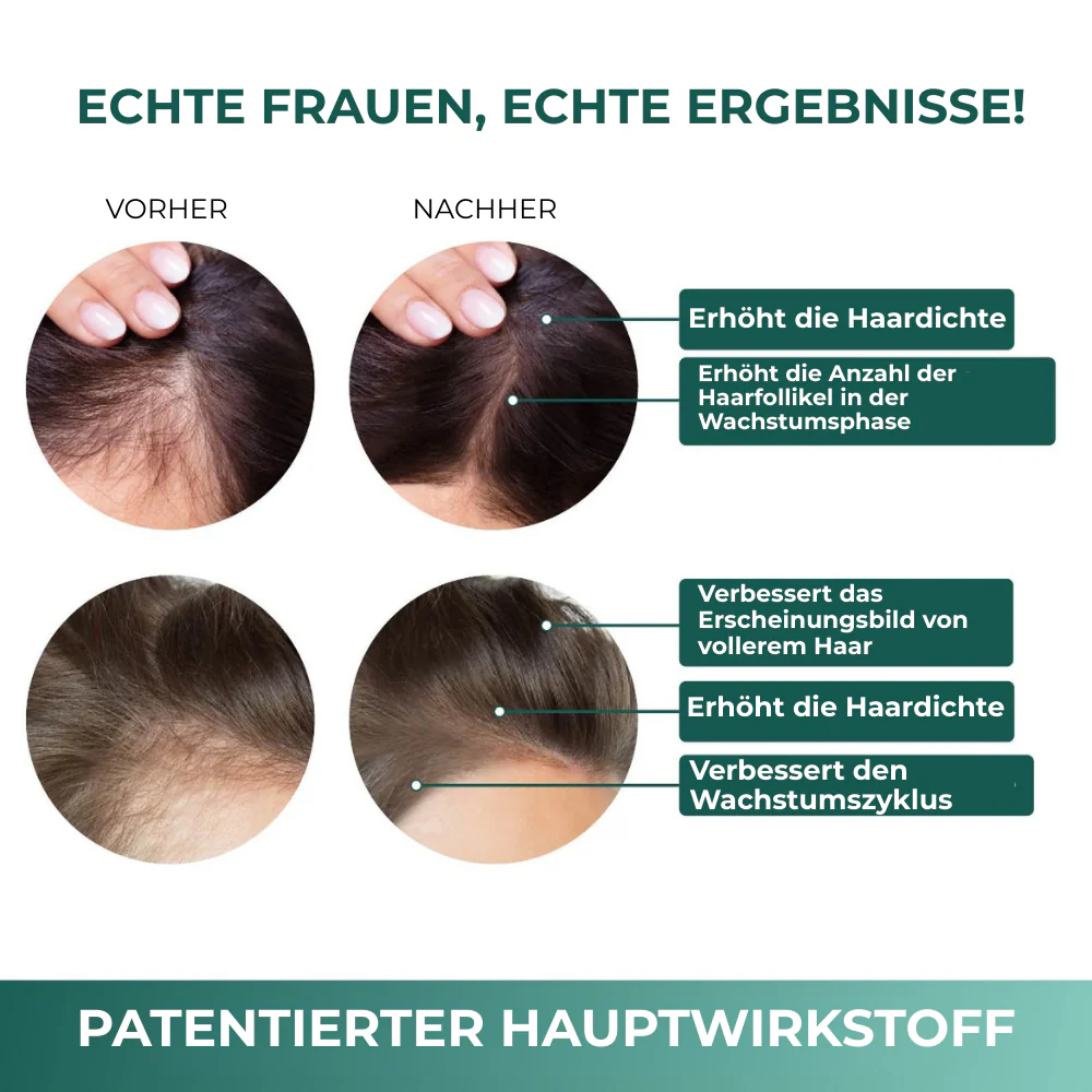 Revive™ | Gummibärchen - Image 4