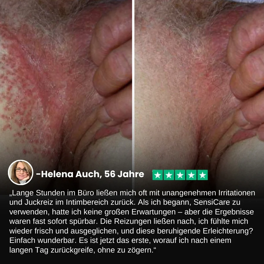 SensiCare™ | Frauen Intimjuckreiz Linderung Creme - Image 5