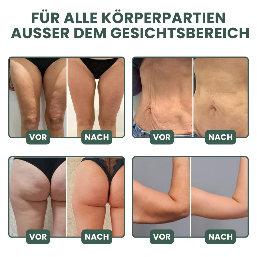 SkinLift™ | Kollagen-Lifting Körperöl - Image 6