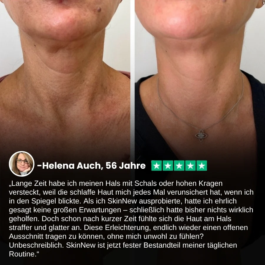 SkinNew™ | Erleben Sie festere, strahlendere und jünger aussehende Haut – mit Ergebnissen schon nach 2 Wochen! - Image 5