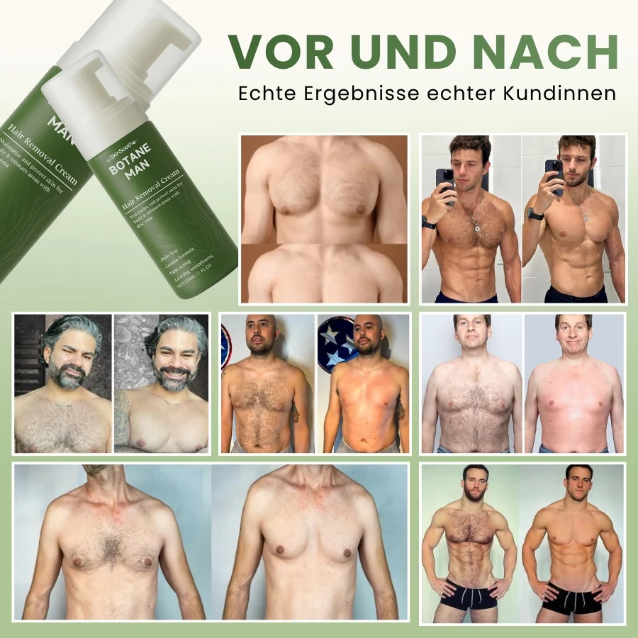 SkinSoothe™ | Haarentfernungscreme - Image 6
