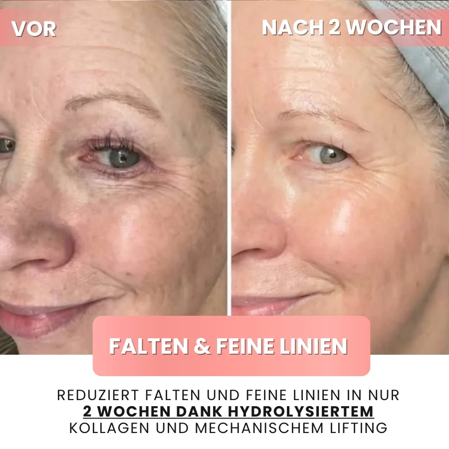 SkynFlow™ | Kollagen- und Niacinamid-Wickelmaske - Image 6