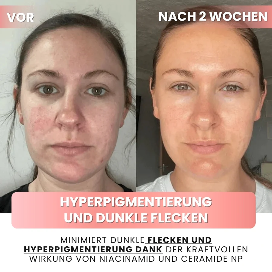 SkynFlow™ | Kollagen- und Niacinamid-Wickelmaske - Image 7