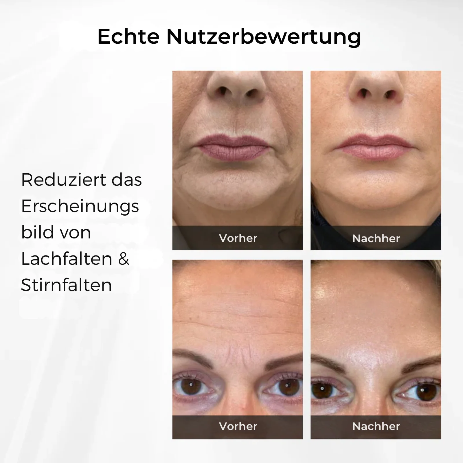 SmoothBright™ | Jugendliche Augen in 90 Sekunden! - Image 9