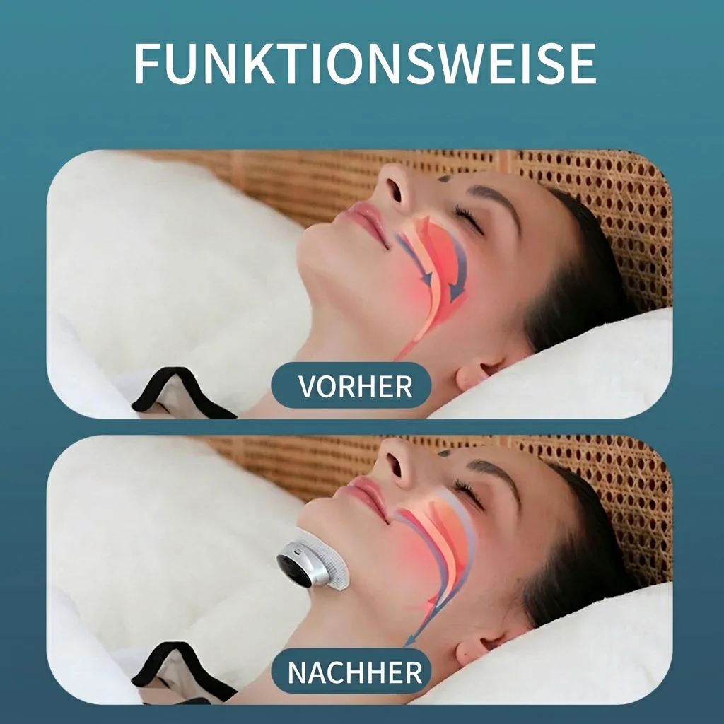 SnoreEnd™ | EMS Anti-Schnarch-Gerät - Image 8