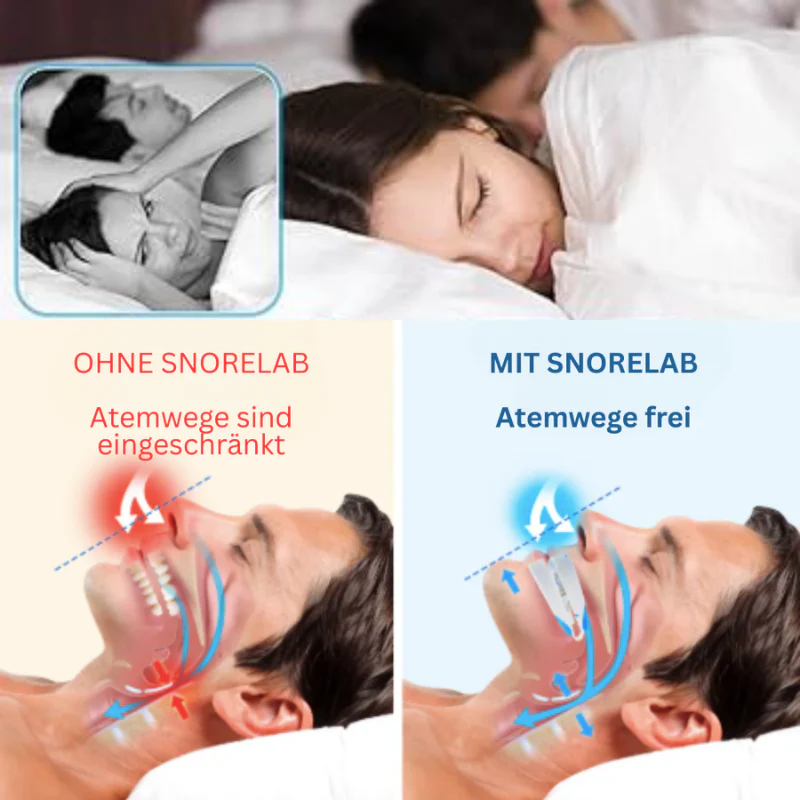 SnoreFree™ | Anti-Schnarch-Mundstück - Image 6