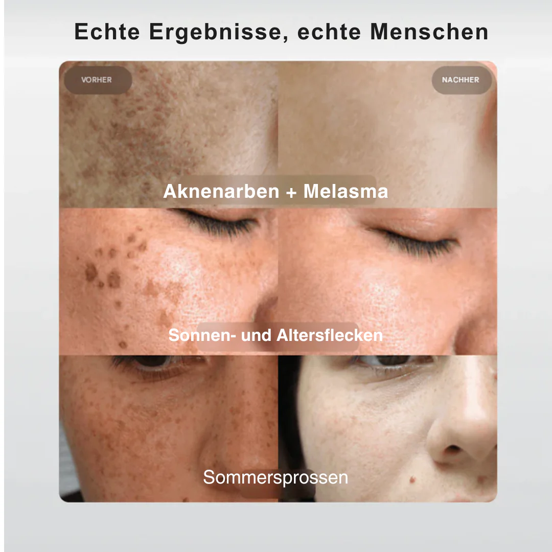 SpotBright™ | Tiefenpflege für das Gesicht - Image 6