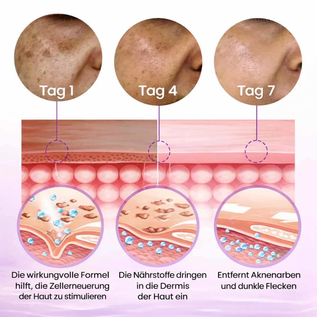 SpotErase™ | Tiefenpflege für das Gesicht - Image 12