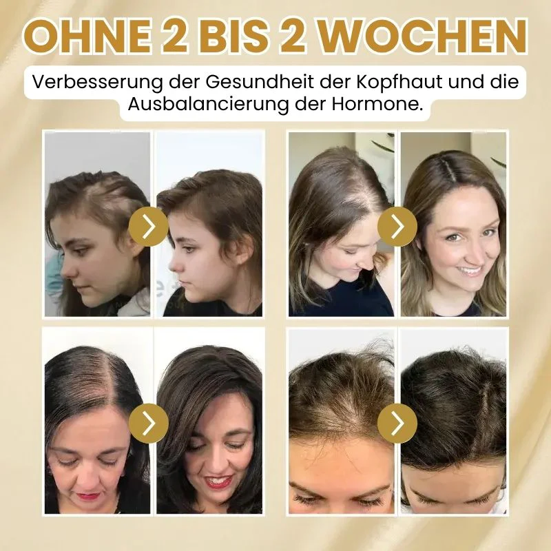 StrandFix™ | Ingwer Haarwuchsserum - Image 8