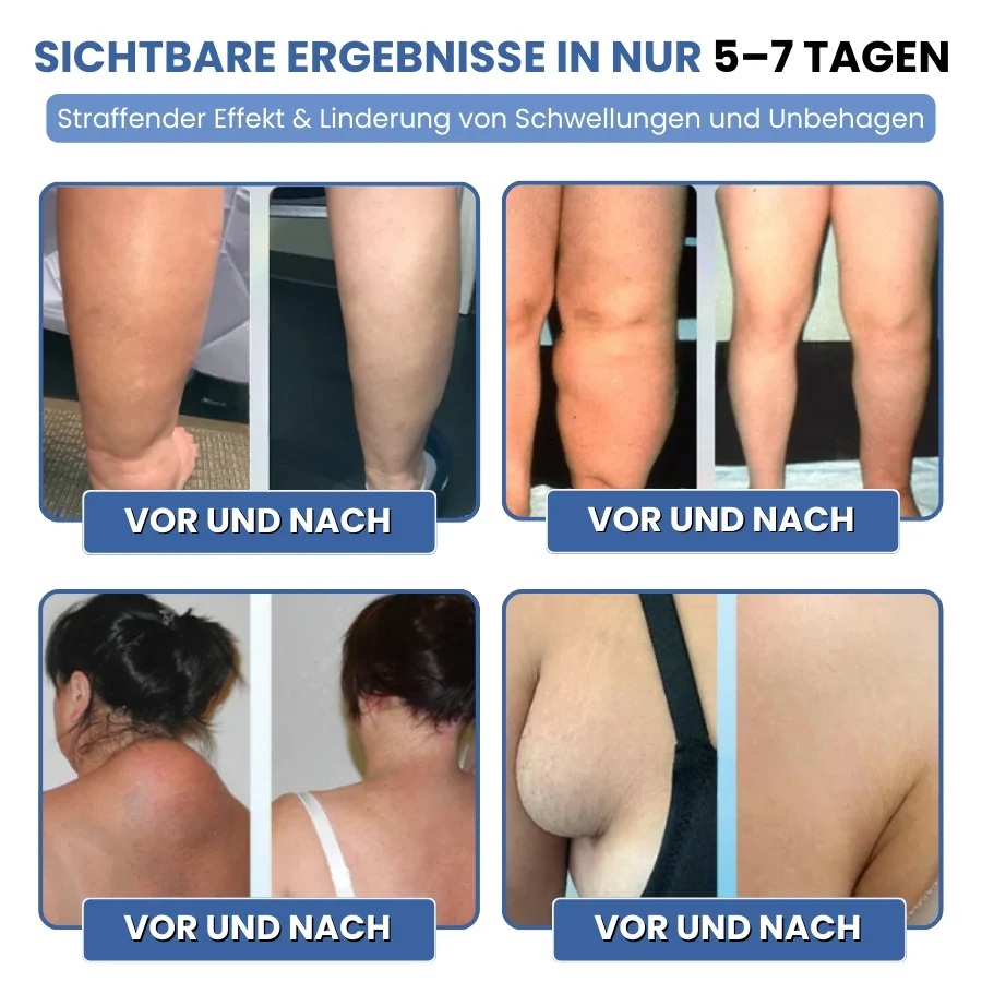 SwelEase™ | Kräutercreme zur Ödempflege - Image 7