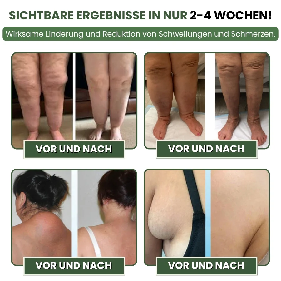 SwellPure™ | Lymphatic Detox Kräutercreme - Image 8