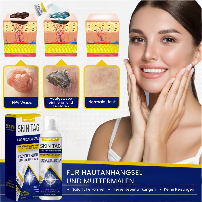 TagFree™ | Cryotherapie Hautanhängsel-Entferner-Spray - Image 5