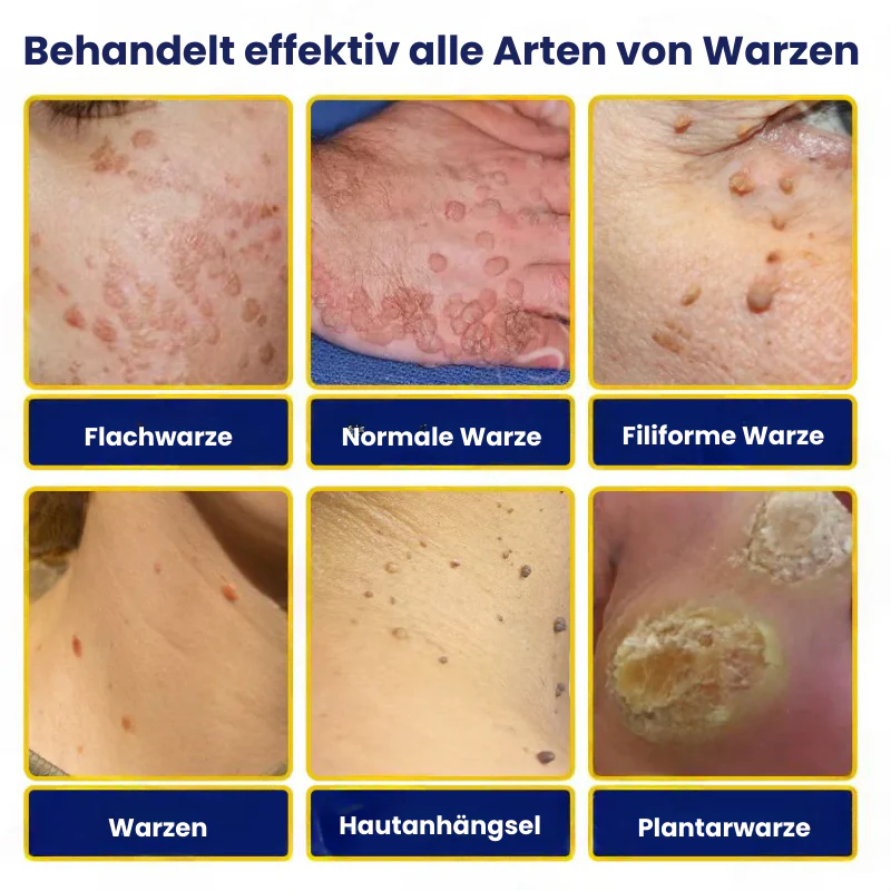 TagFree™ | Cryotherapie Hautanhängsel-Entferner-Spray - Image 6