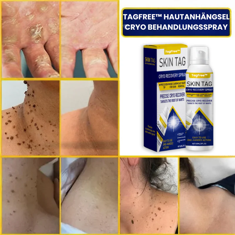 TagFree™ | Cryotherapie Hautanhängsel-Entferner-Spray - Image 8
