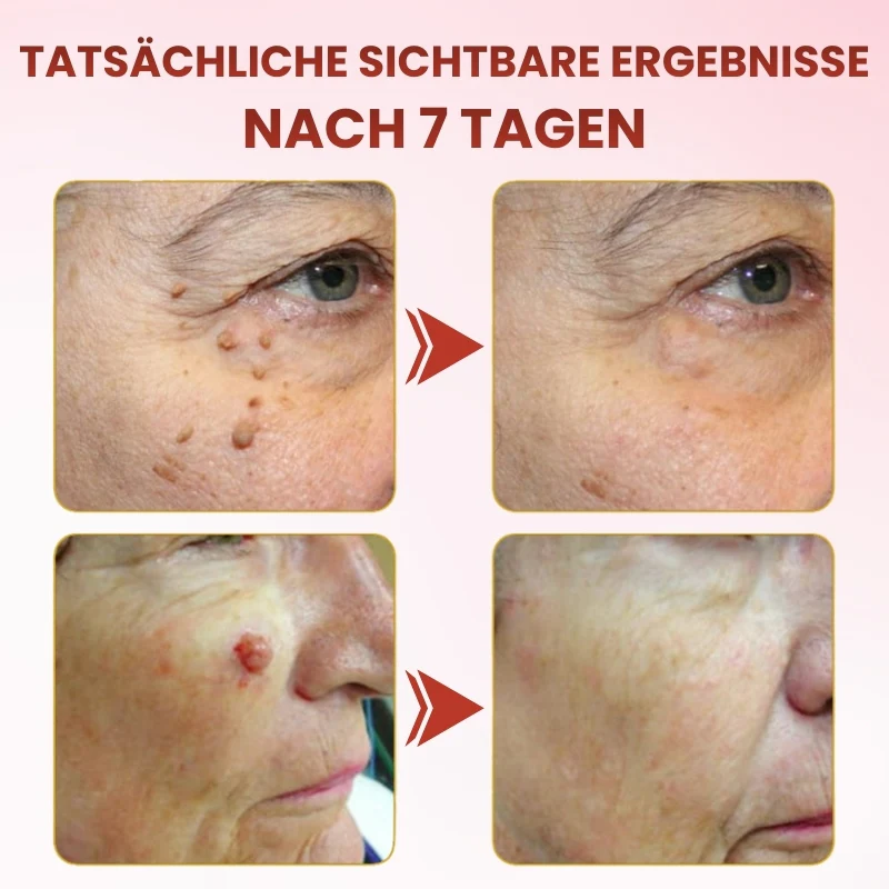 TagGone™ | Schmerzfreie Hautanhängsel-Entfernung mit MicroDart-Pflastern - Image 8