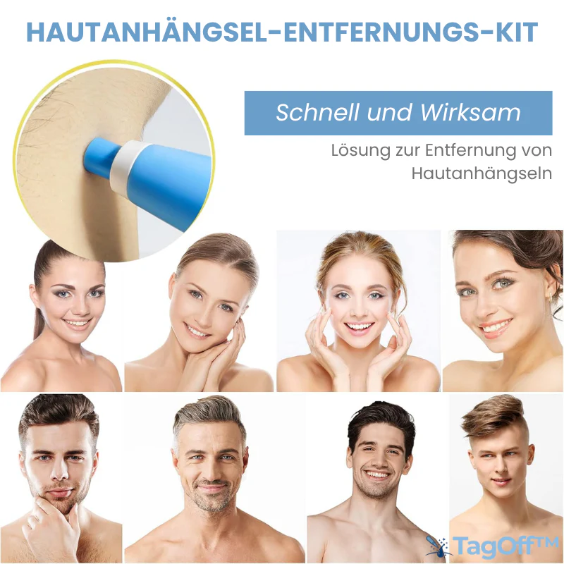 TagOff™ | Komplettset zur Entfernung von Hautanhängseln - Image 6