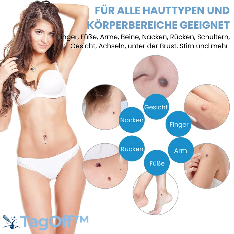 TagOff™ | Komplettset zur Entfernung von Hautanhängseln - Image 8