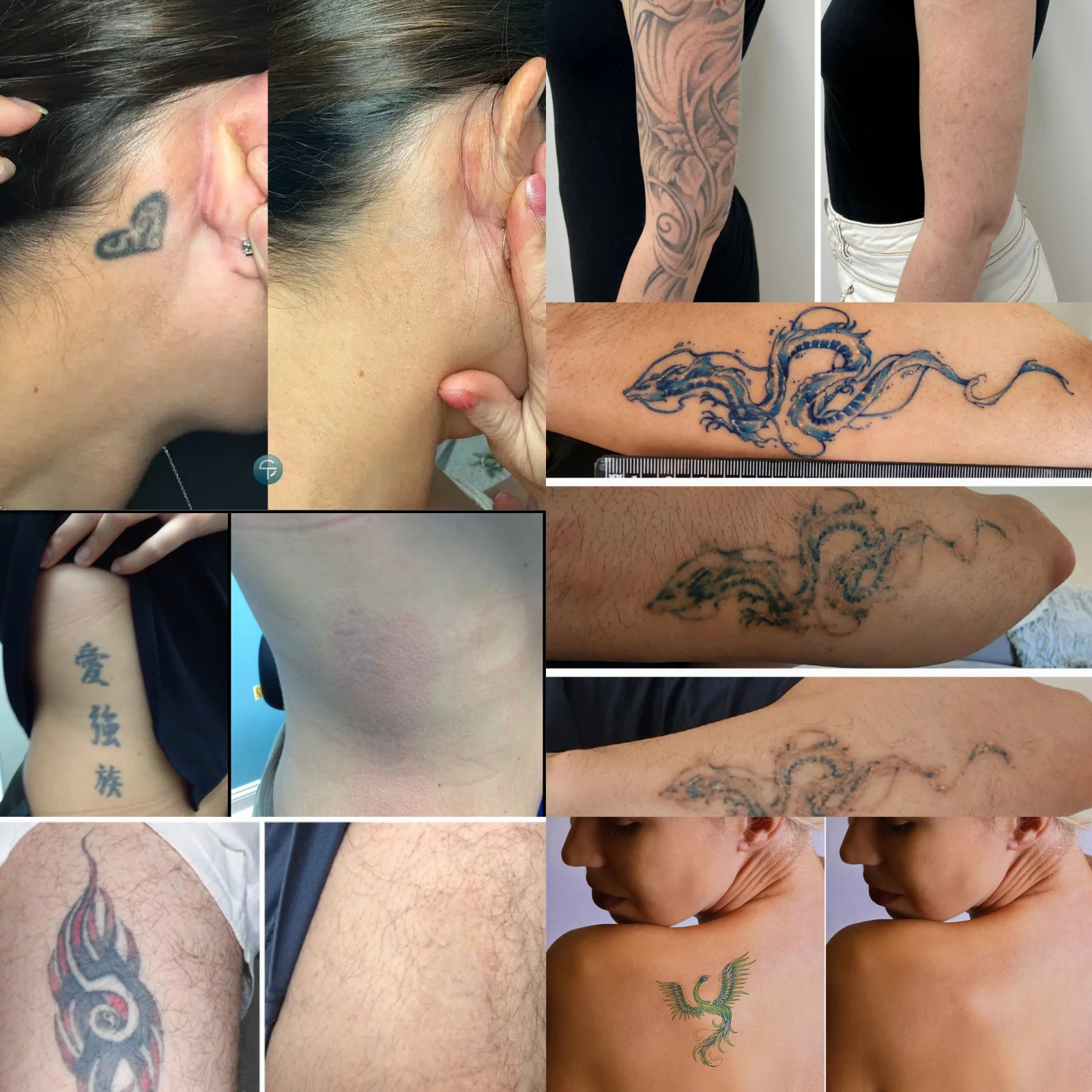 TattWeg™ Sprühflasche | 99% Tattoo Tinte entfernt! - Image 5