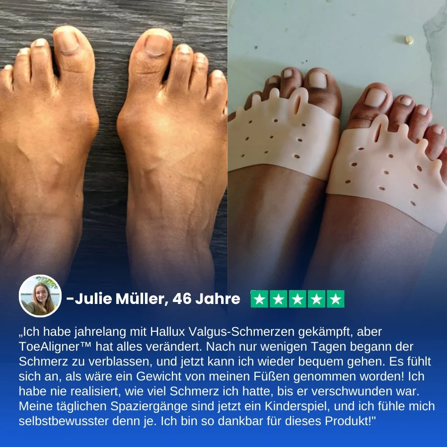 ToeAligner™ | Hallux Valgus Therapeutische Einlegesohlen - Image 3