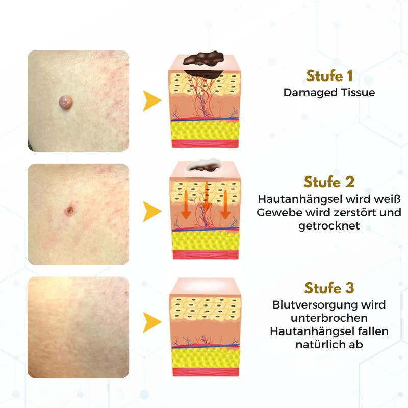 VanishPro™ | Hautpflege zur Entfernung von Hautflecken und Hautanhängseln - Image 10