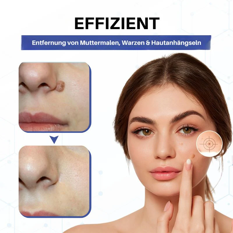 VanishPro™ | Hautpflege zur Entfernung von Hautflecken und Hautanhängseln - Image 3