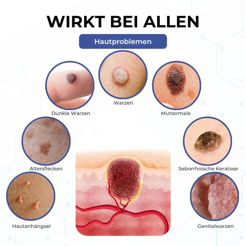VanishPro™ | Hautpflege zur Entfernung von Hautflecken und Hautanhängseln - Image 7