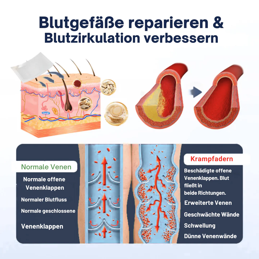 VariEase™ Deep Vein Repair Mikronadel-Pflaster - Image 11