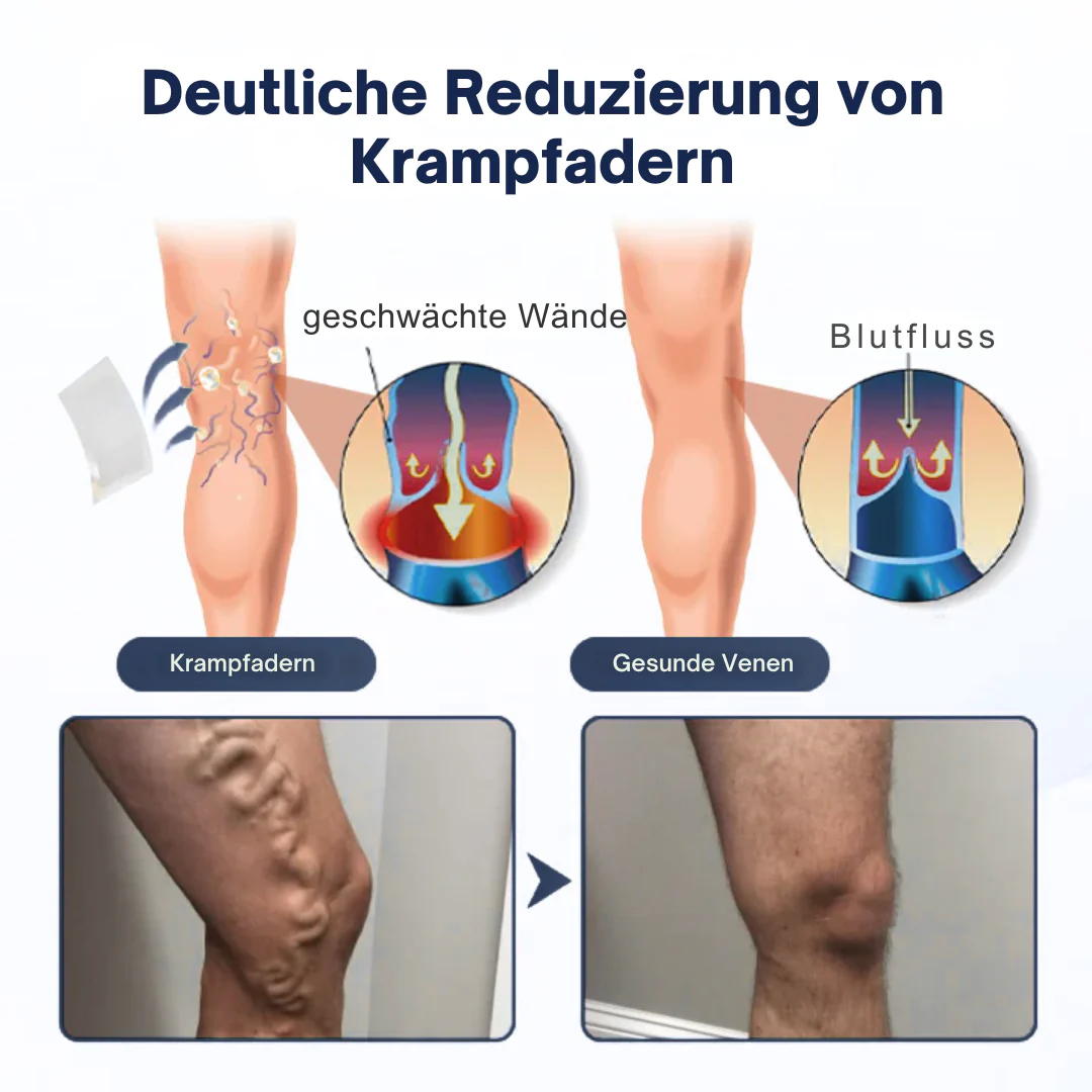 VariEase™ Deep Vein Repair Mikronadel-Pflaster - Image 6