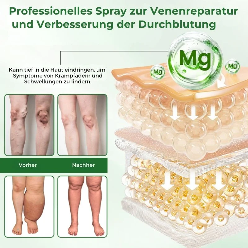 VeinFlex™ | Reduziere Krampfadern um 97 % in nur 2 Wochen! - Image 3