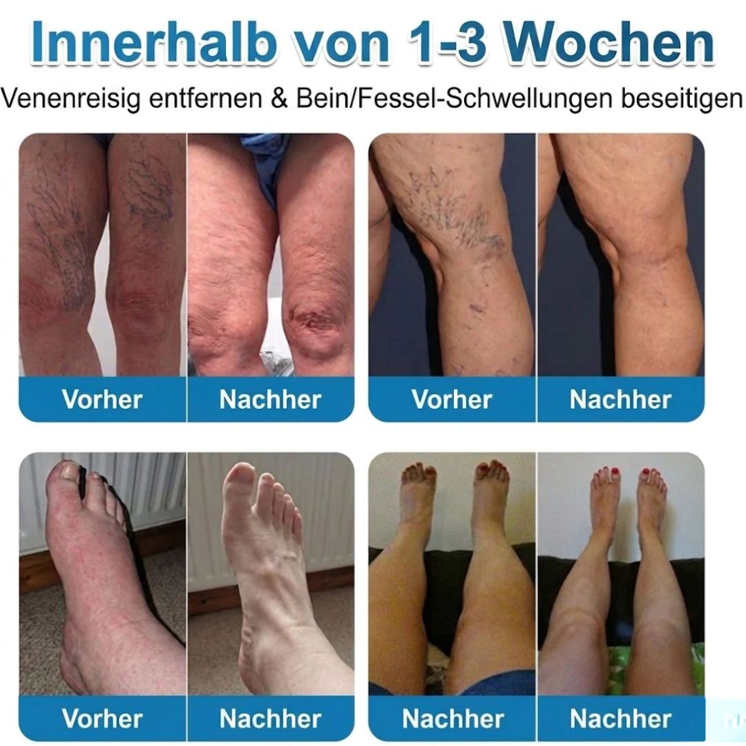 VeinRepair™ | Mikronadel-Pflaster - Image 9