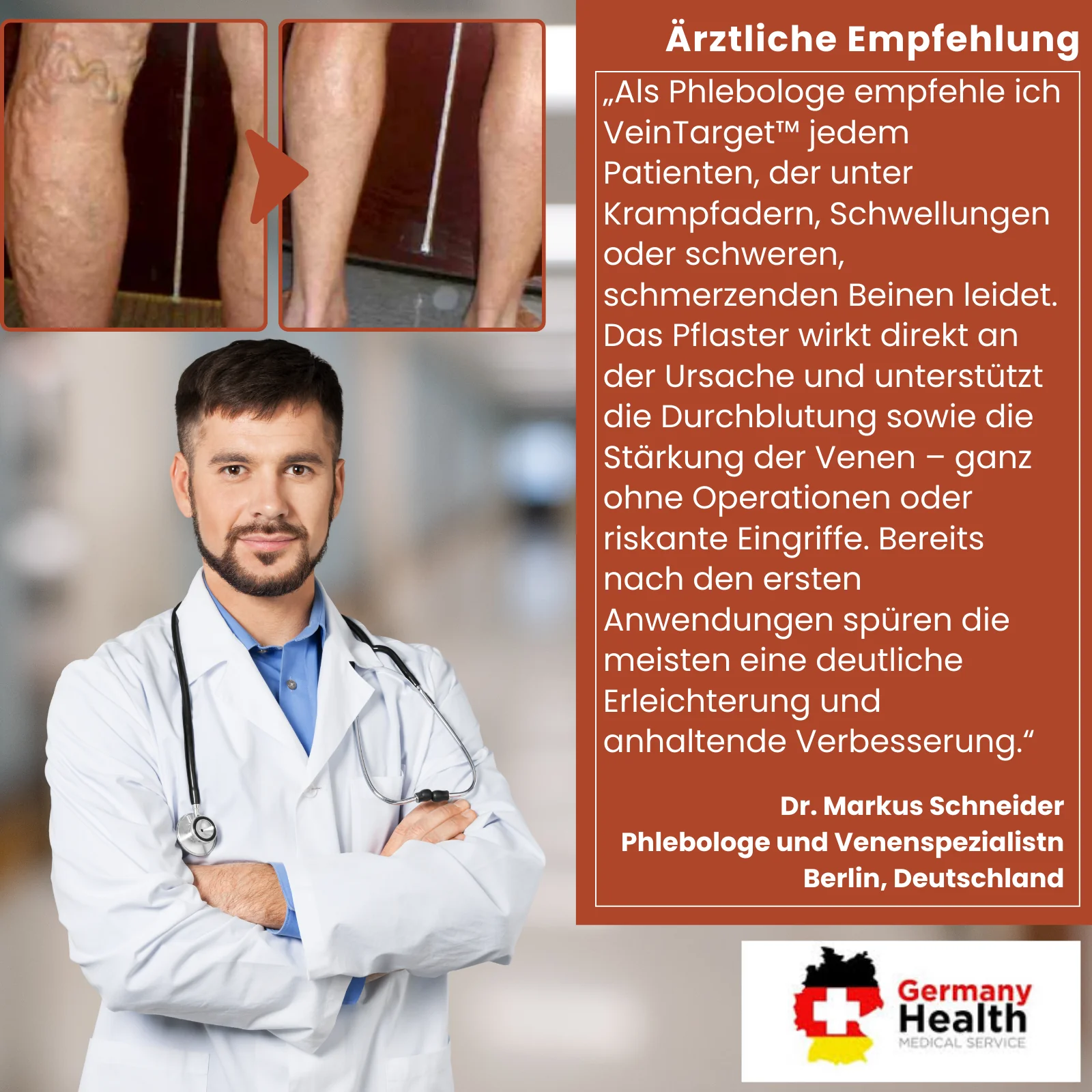 VeinTarget™ | 95 % Linderung – Sichtbare Venenveränderung - Image 2