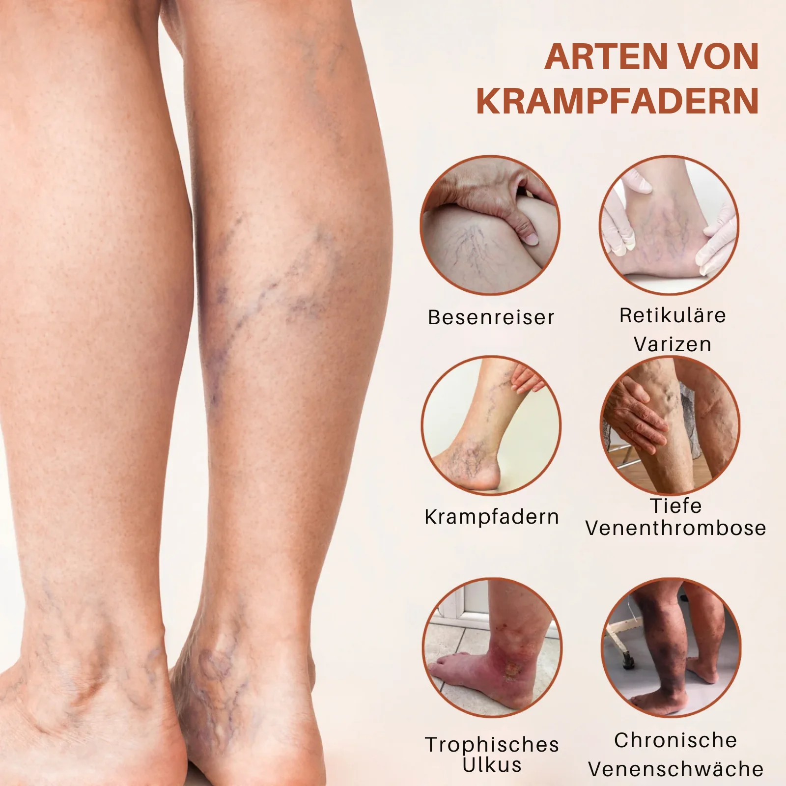 VeinTarget™ | 95 % Linderung – Sichtbare Venenveränderung - Image 6