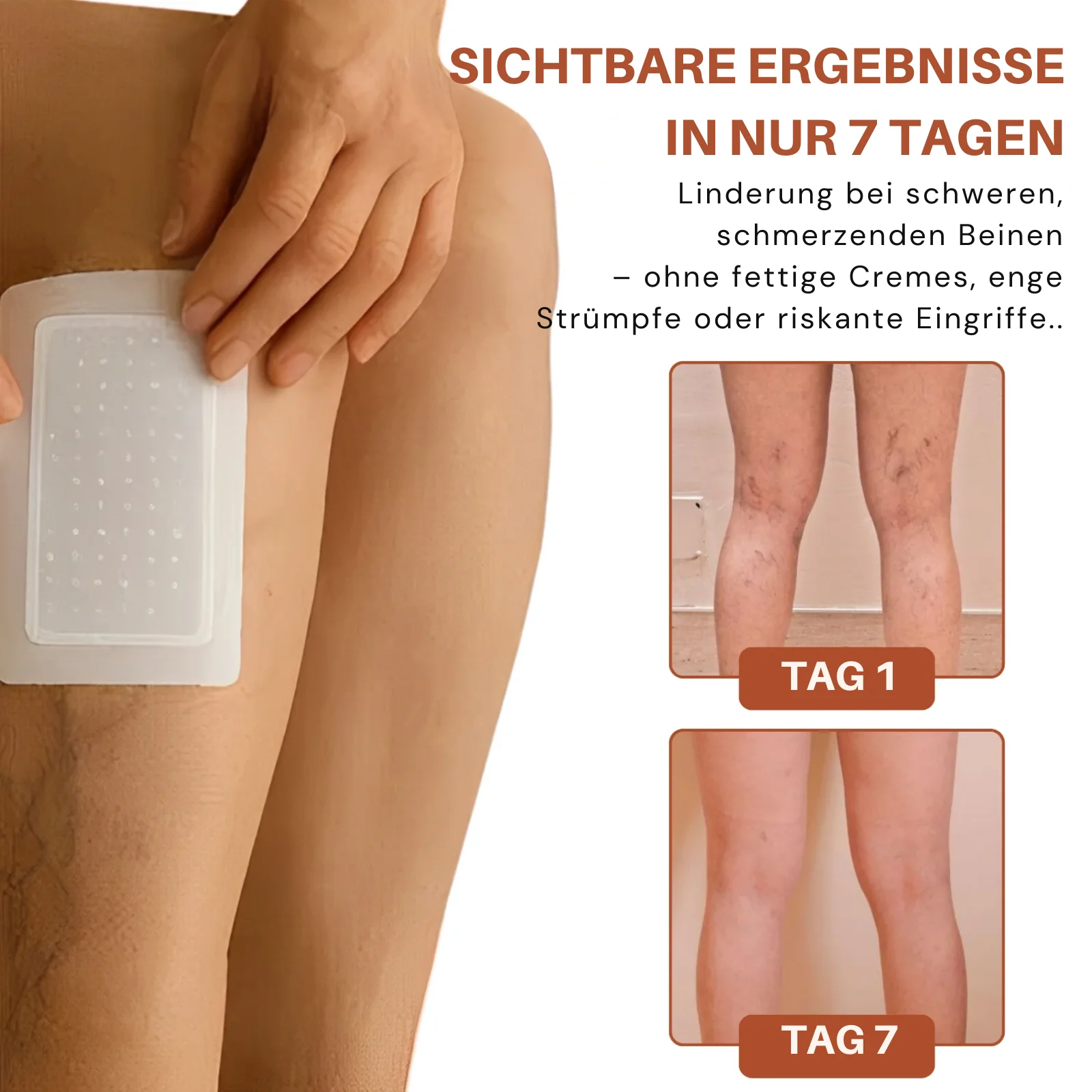 VeinTarget™ | 95 % Linderung – Sichtbare Venenveränderung - Image 7