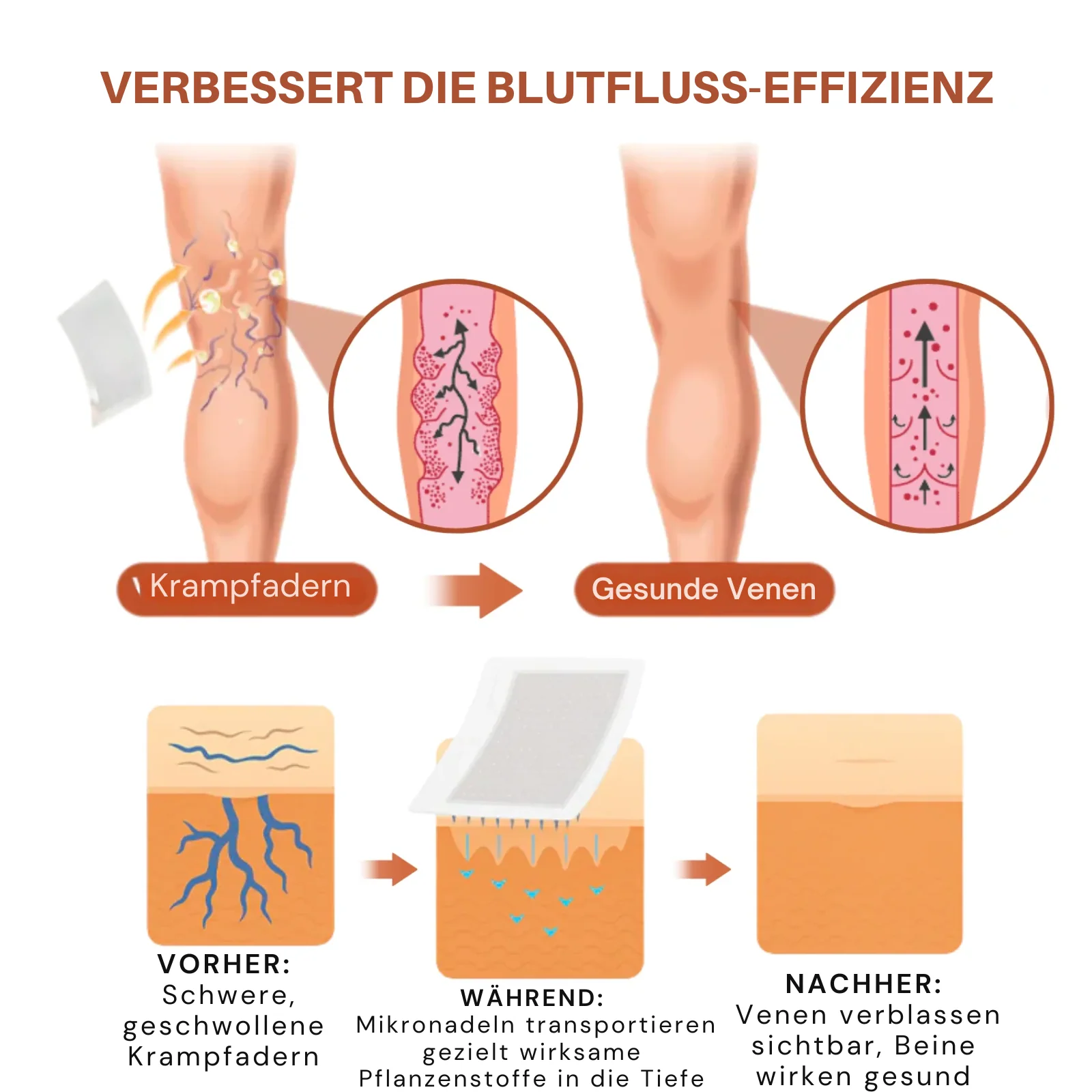VeinTarget™ | 95 % Linderung – Sichtbare Venenveränderung - Image 8