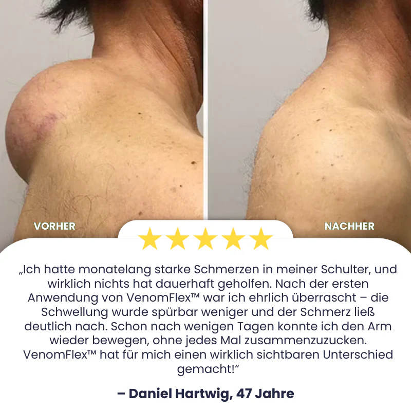 VenomFlex™ | Schmerzcreme mit gereinigtem Bienengift - Image 3