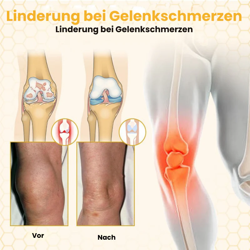 VenomFlex™ | Schmerzcreme mit gereinigtem Bienengift - Image 5
