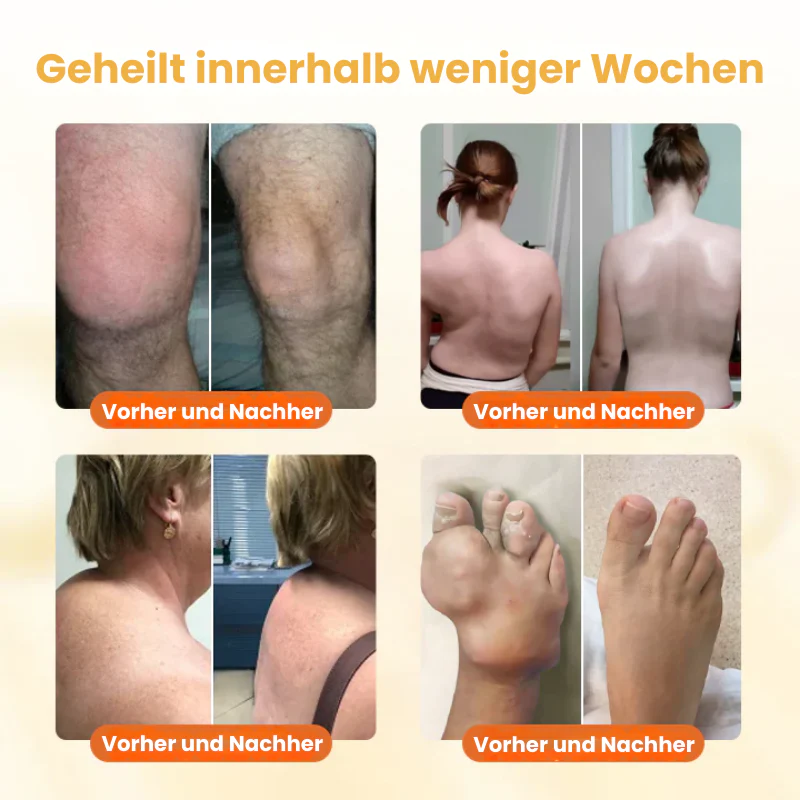 VenomFlex™ | Schmerzcreme mit gereinigtem Bienengift - Image 7