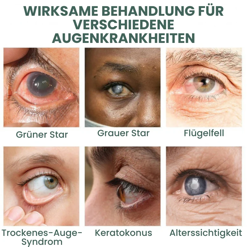Vision Pro™ | Nano Augentropfen - Image 11