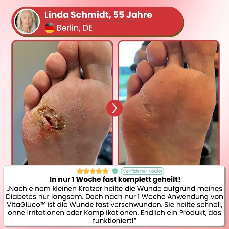 VitaGluco™ | Diabetische Wundpflegecreme - Image 4