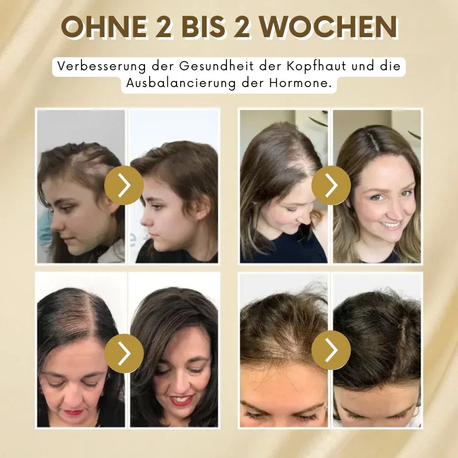 VitaGrow™ | Biotin Haarwuchs-Spray - Image 12