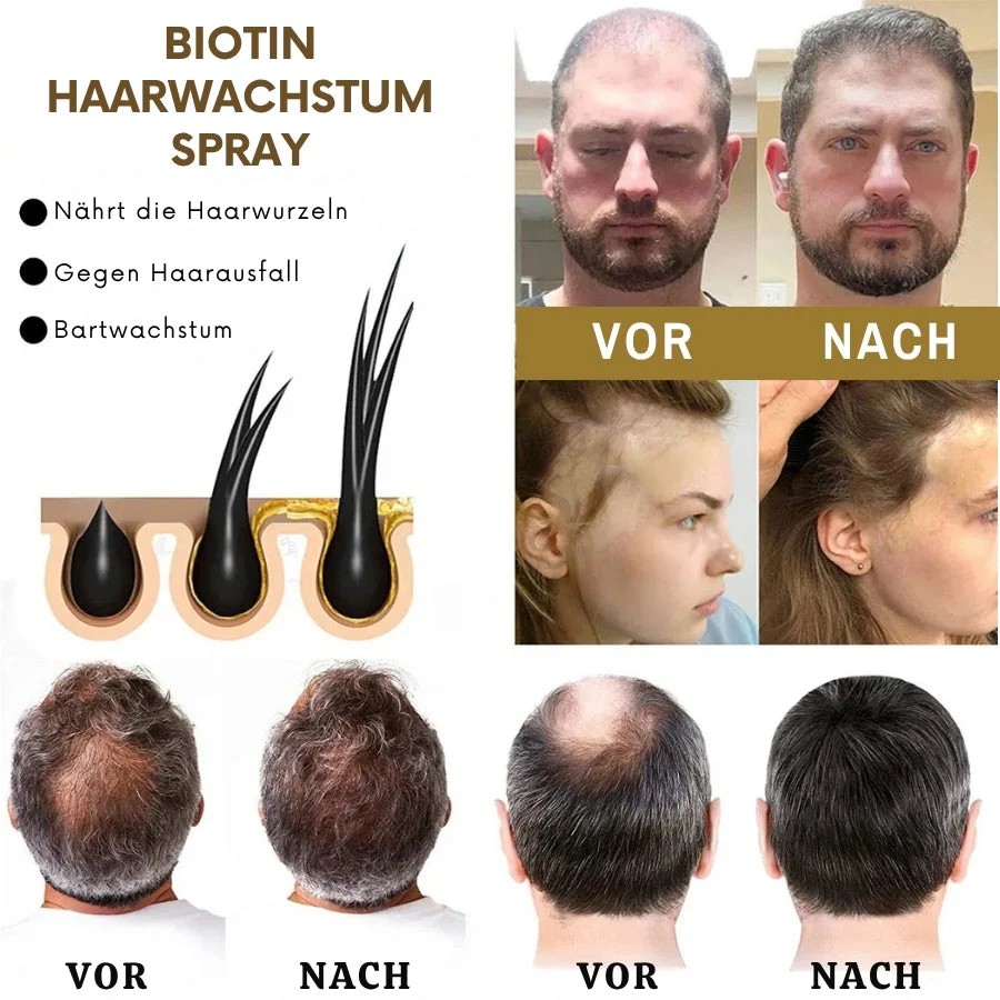 VitaGrow™ | Biotin Haarwuchs-Spray - Image 5