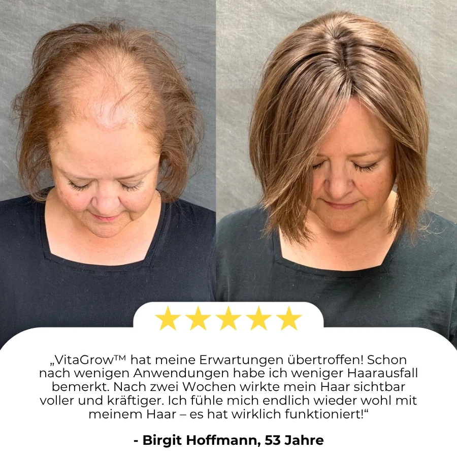 VitaGrow™ | Biotin Haarwuchs-Spray - Image 6