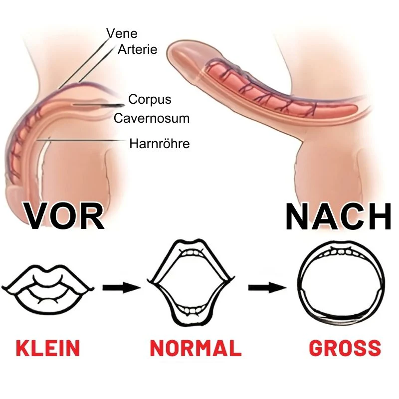 VitaPatch™ | Pflaster gegen Erektionsstörungen - Image 8