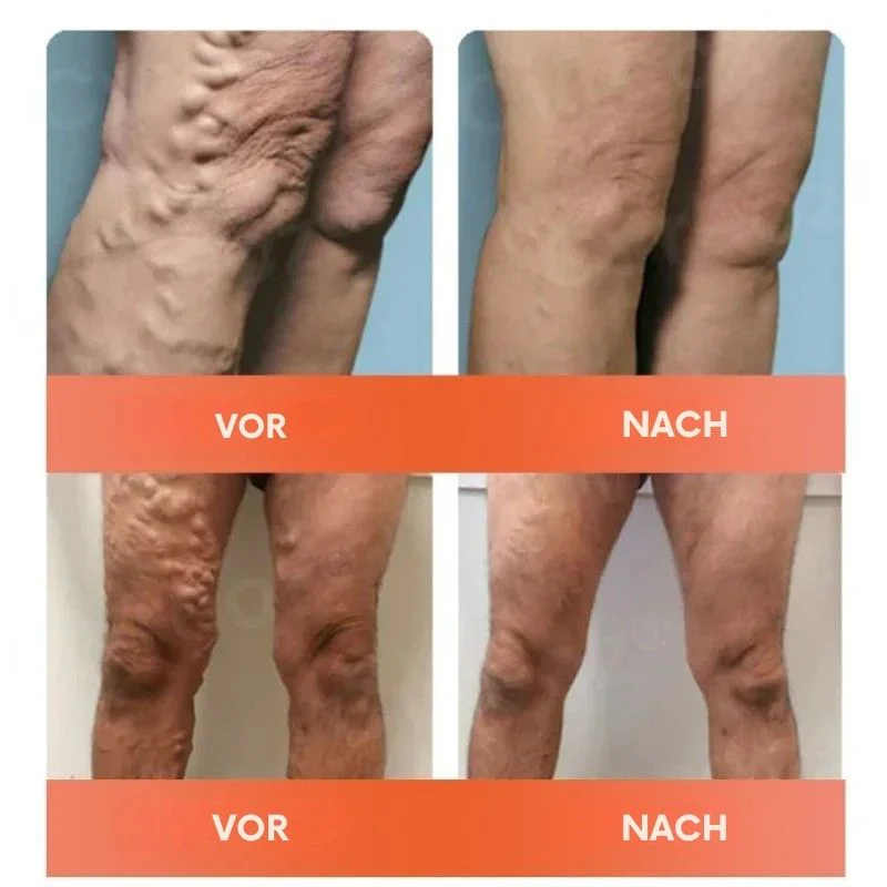 VitaVene™ | Natürliche Venenpflege-Kapseln - Image 5