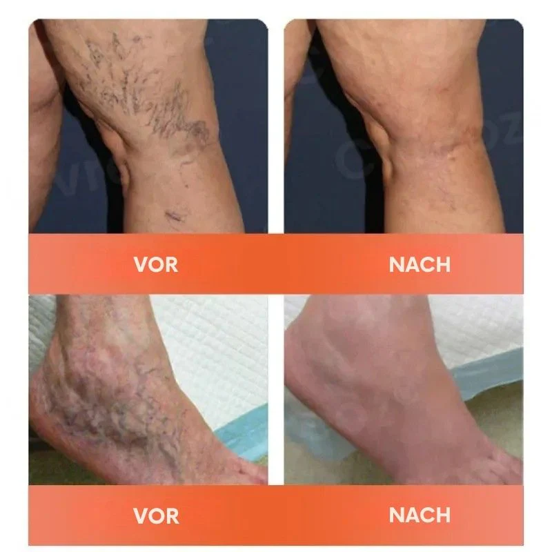 VitaVene™ | Natürliche Venenpflege-Kapseln - Image 6
